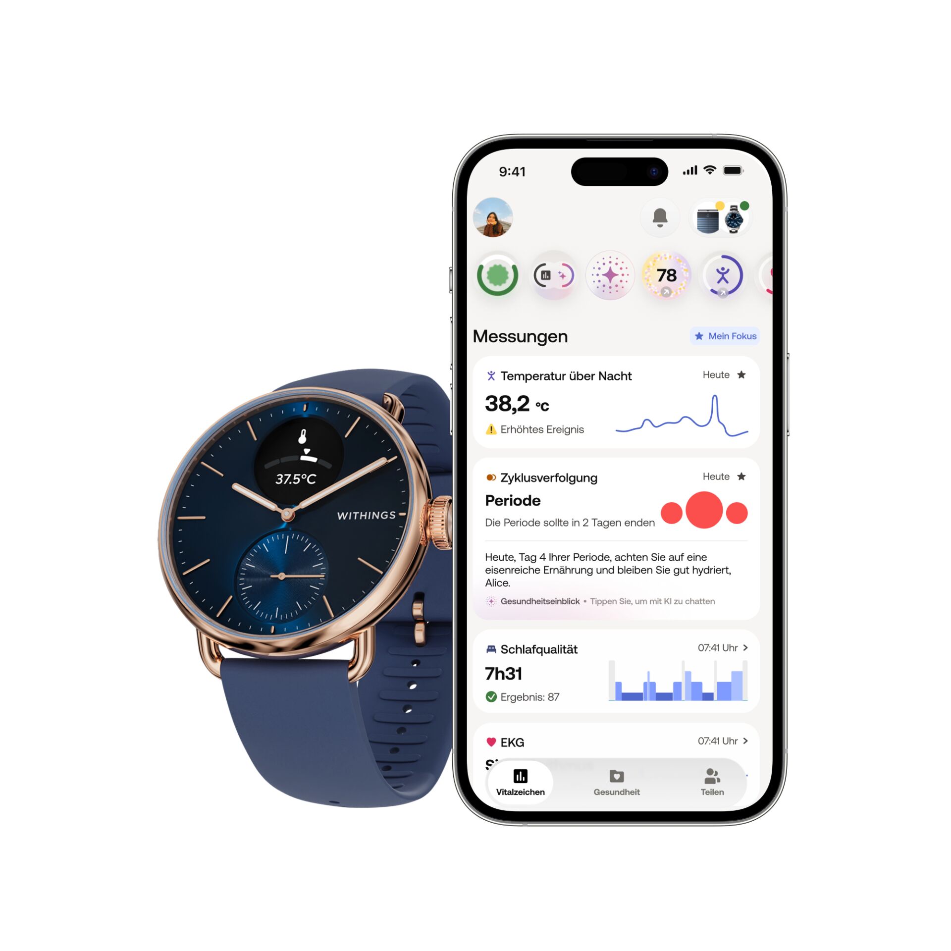 Armbanduhr, Arm, Körperteil, Person, Armbanduhr, Arm, Elektronik, Handy, Telefon
