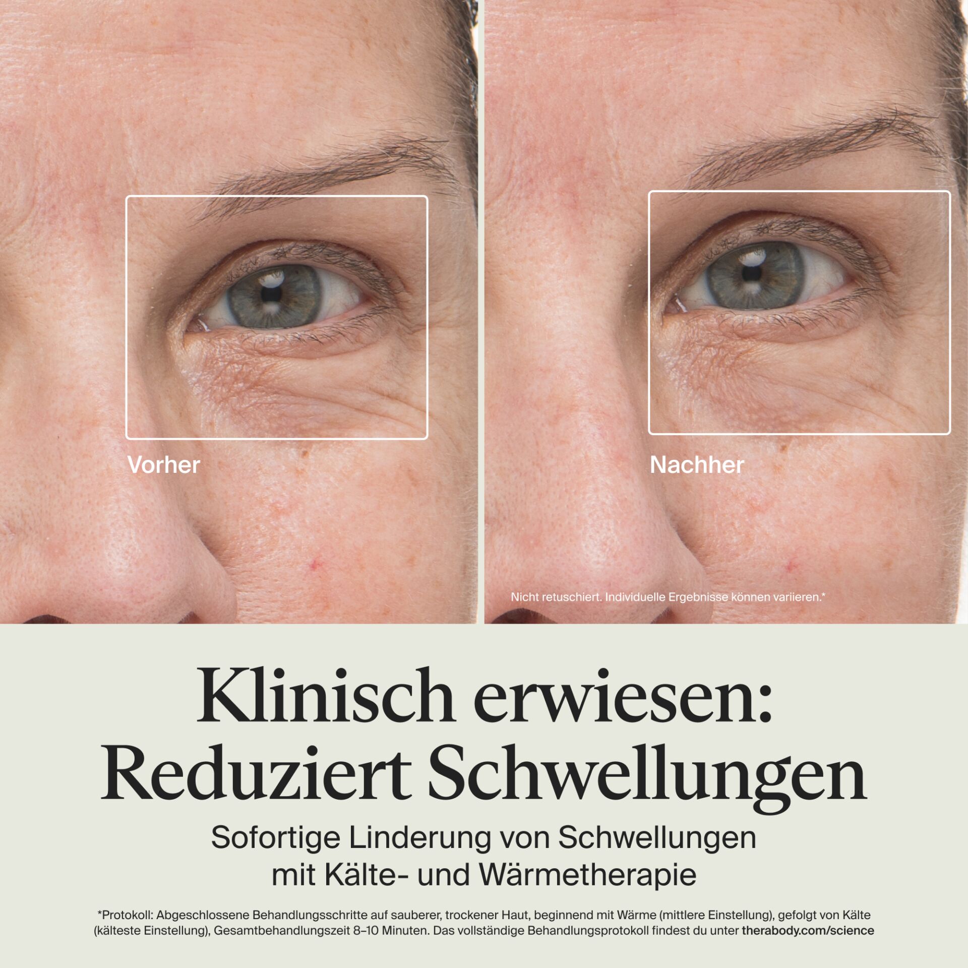 Auge, Augenpflege, Falten, Vorher Nachher, Hautbehandlung