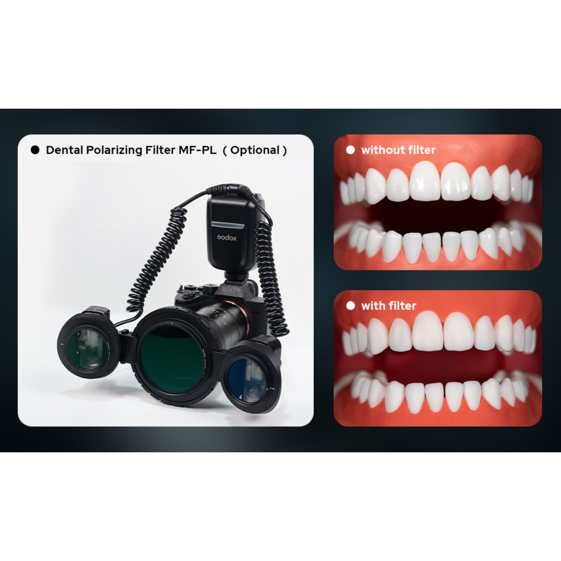 Dentalbrille, Polariser, Medizinisches Gerät, Brille, Kamerazubehör