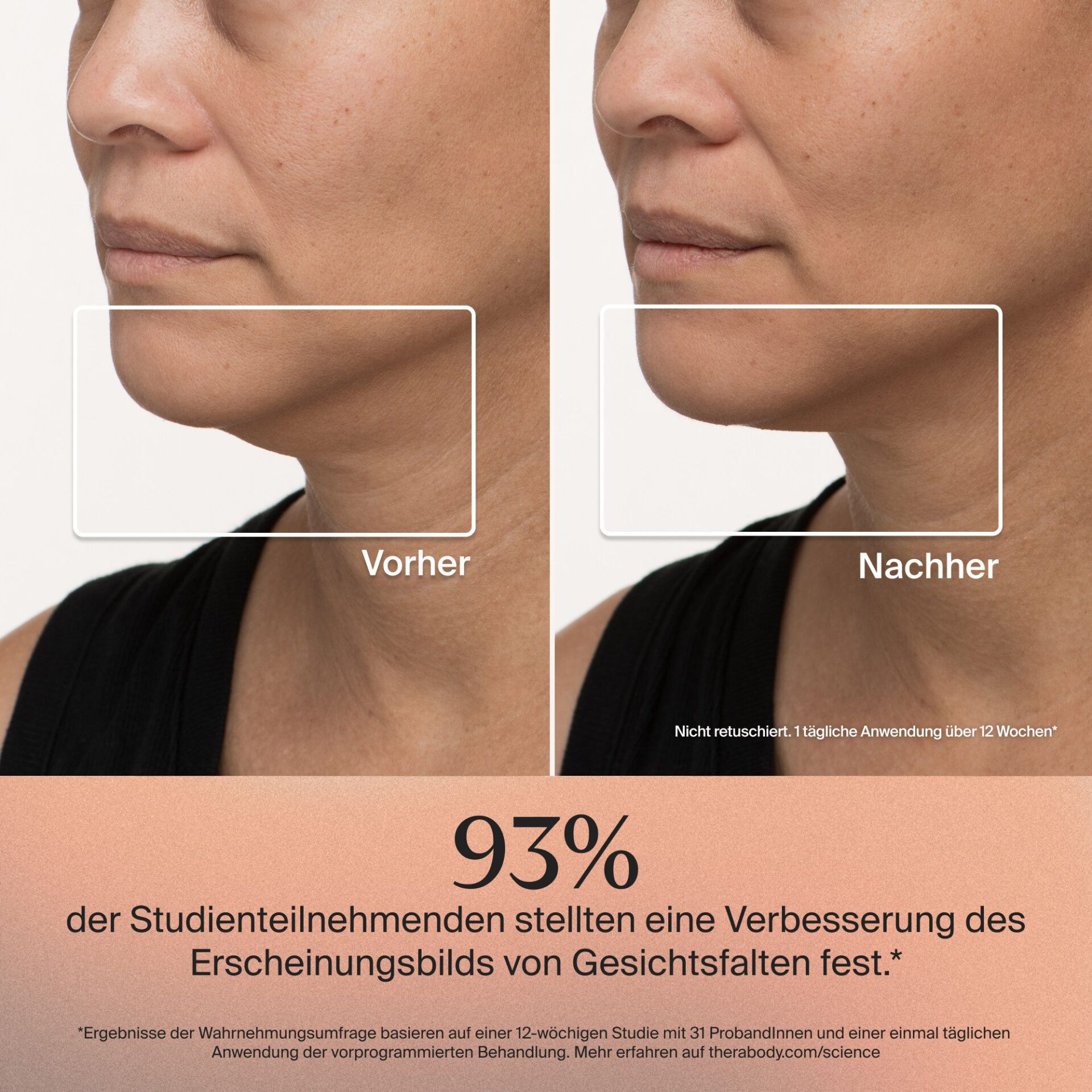 Kinn, Doppelkinn, Hautstruktur, Hautunreinheiten, Gesicht